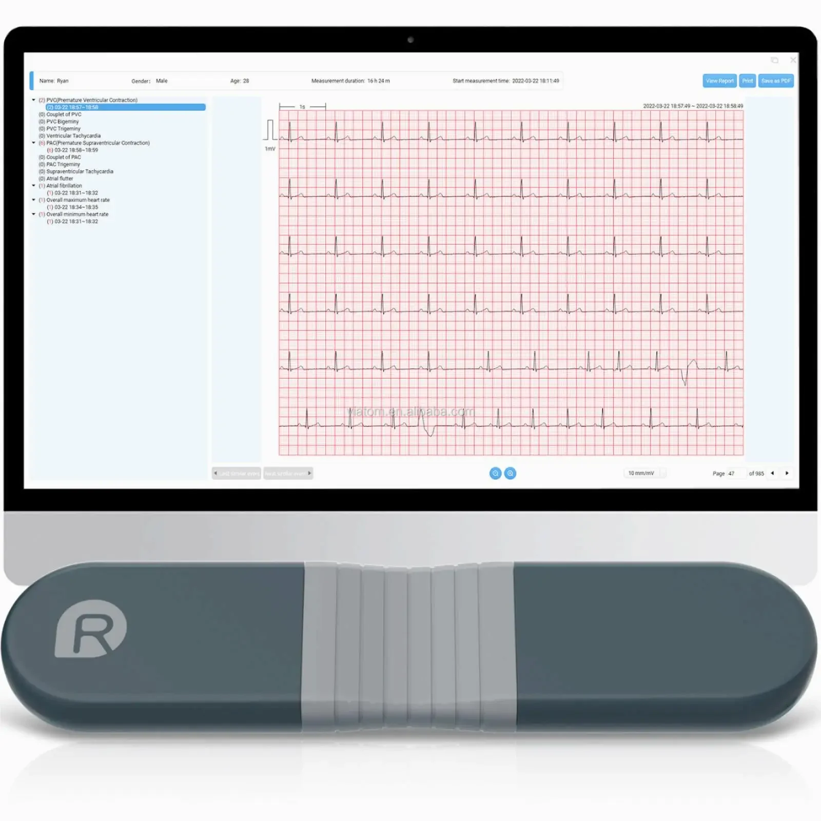 Wireless Bluetooth Dynamic Rec – обзор и цена Ecg Patch Monitor